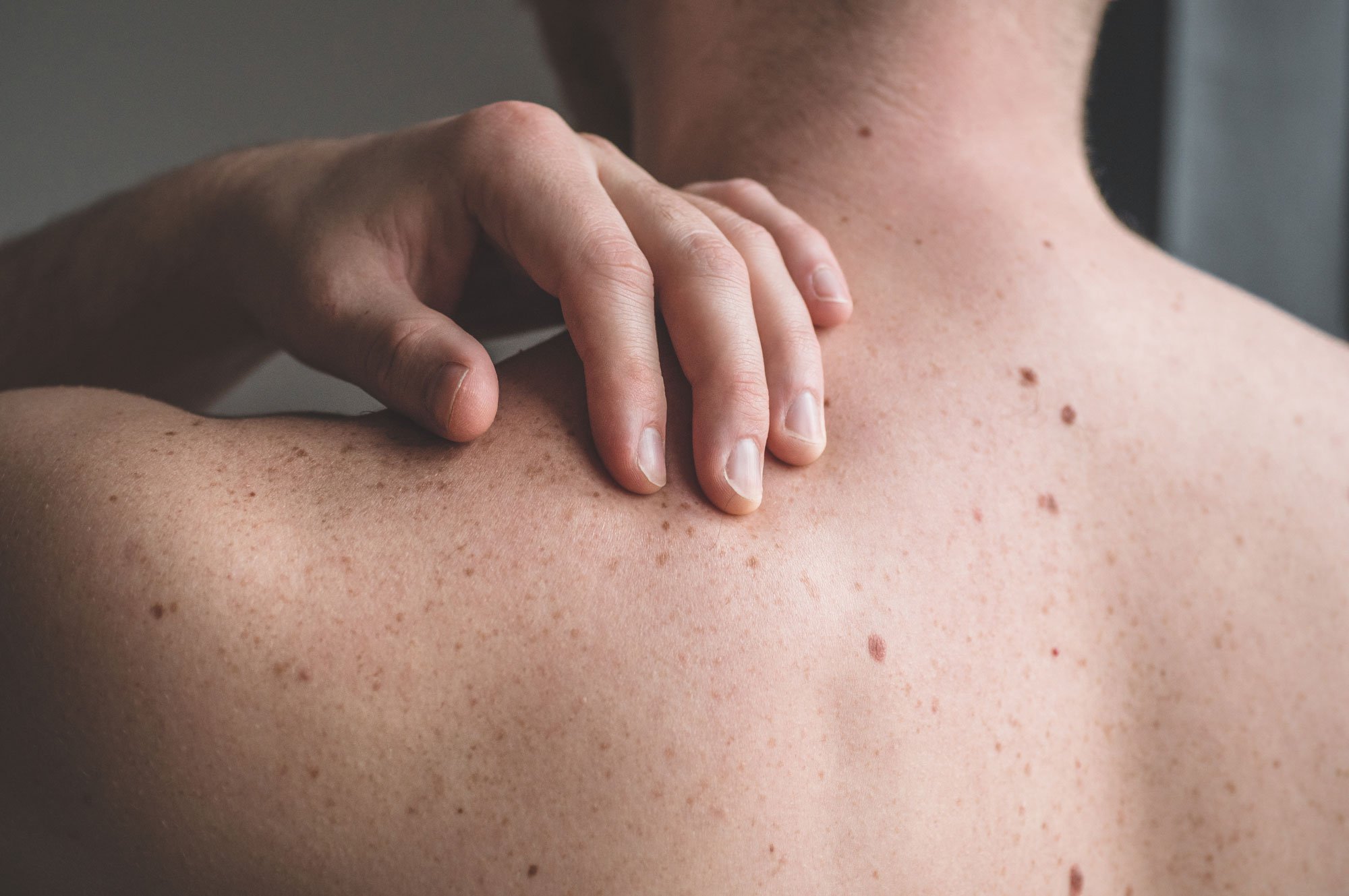 What To Know About Skin Cancer And Skin Checks One Medical